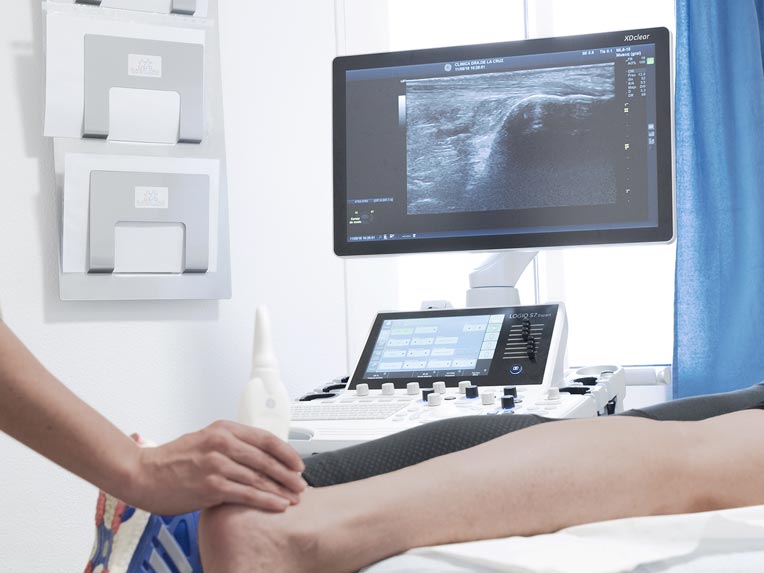 Máster en Fisioterapia Deportiva Avanzada